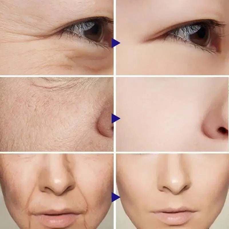 Retinol Wrinkle Remover Face Set Instant Firming Lifting Anti-Aging Serum Fade Fine Lines Whitening Korean Skin Care Products