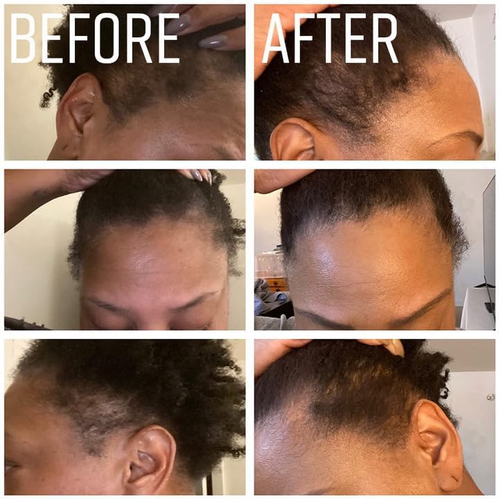 Natural Jamaican Black Castor Oil for Hair and Skin Conditioning, 100% Pure Cold Pressed, Scalp, Nail and Hair Oil (Unscented) (4oz)