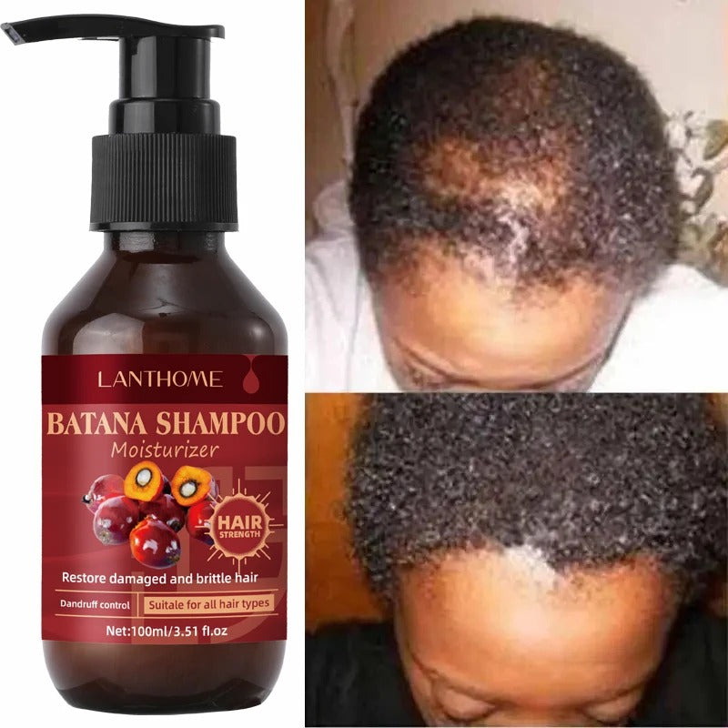 Batana Oil Shampoo Hair Loss Products Effective In 7 days Pure And Natural Batana Oil