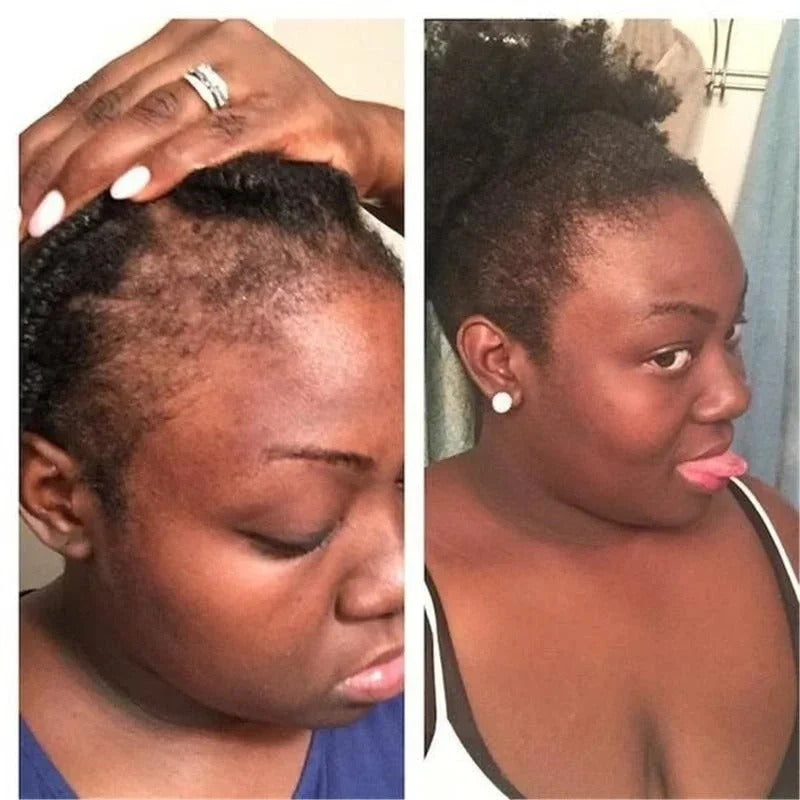 Batana Oil Shampoo Hair Loss Products Effective In 7 days Pure And Natural Batana Oil