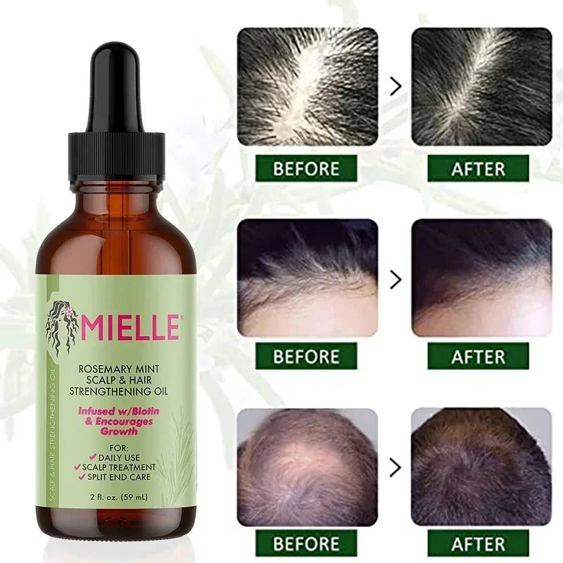 Original Mielle Rosemary Mint Scalp Hair Strengthening Oil Nourishes And Strengthens