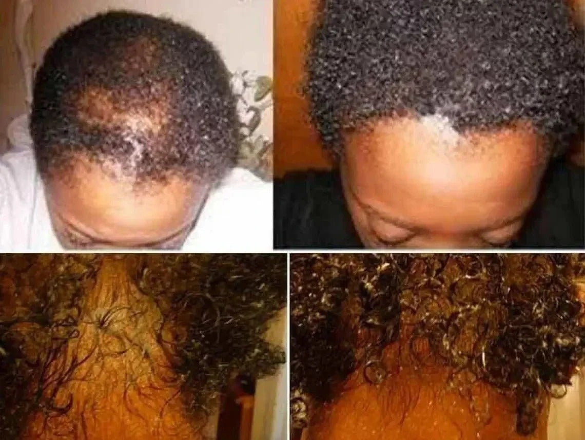 Batana Oil Shampoo Hair Loss Products Effective In 7 days Pure And Natural Batana Oil