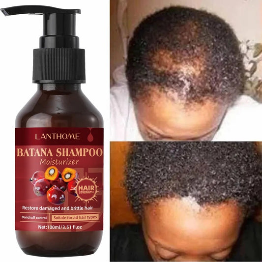Batana Oil Shampoo Hair Loss Products Effective In 7 days Pure And Natural Batana Oil