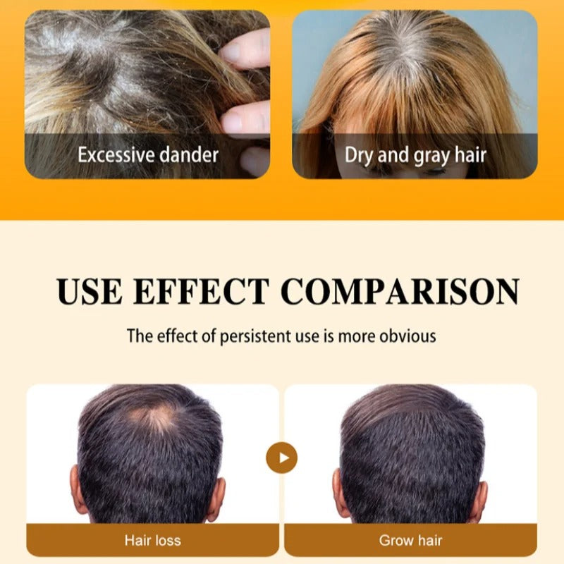 100% Pure And Natural Batana Oil For Treating Hair Loss Anti-Breakage Hair